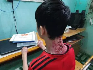THĂM EM NGUYỄN HỮU VIỆT HOÀNG